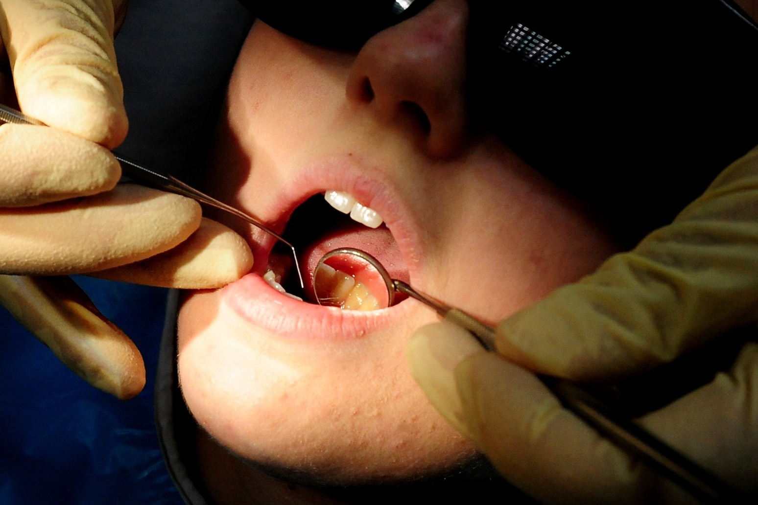 Warnings parts of England becoming ‘dental deserts’ due to NHS dentist shortage 
